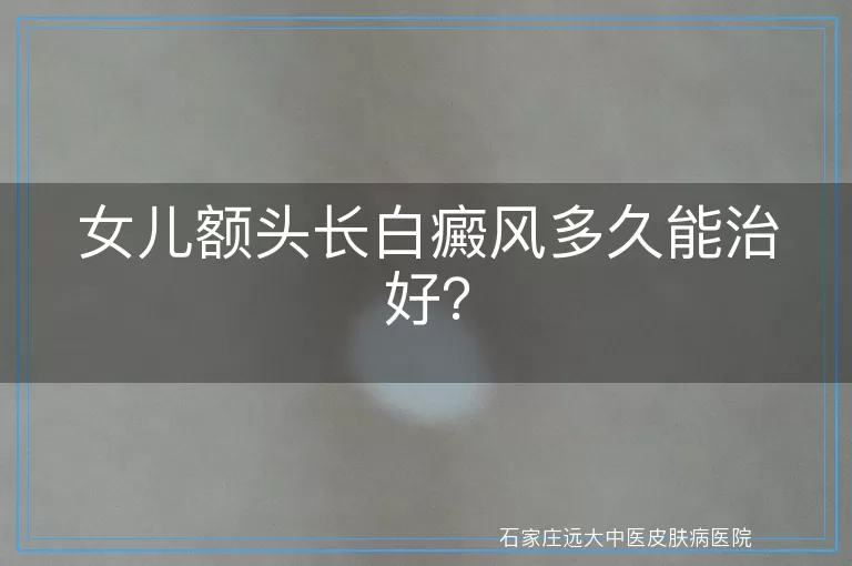 女儿额头长白癜风多久能治好？