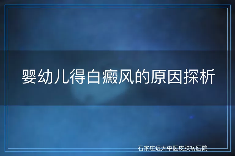婴幼儿得白癜风的原因探析