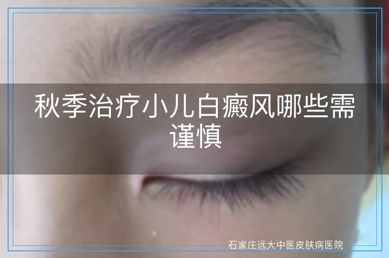 秋季治疗小儿白癜风哪些需谨慎