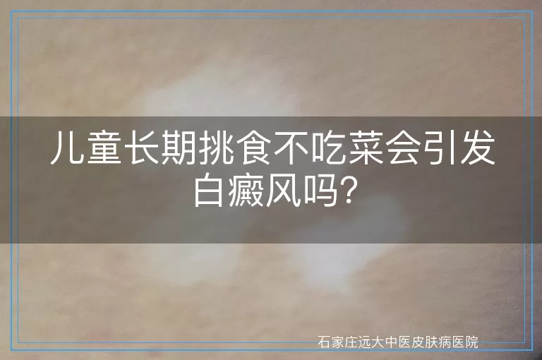 儿童长期挑食不吃菜会引发白癜风吗？