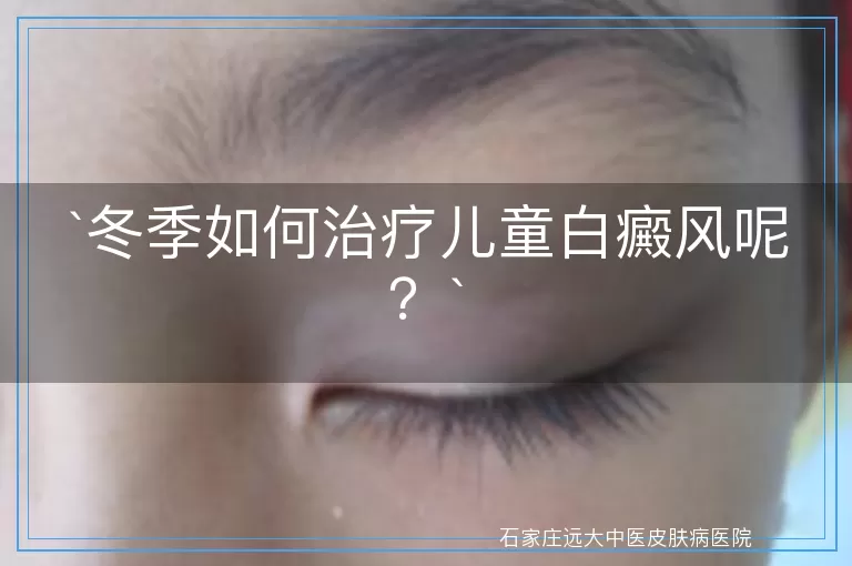 冬季如何治疗儿童白癜风呢？