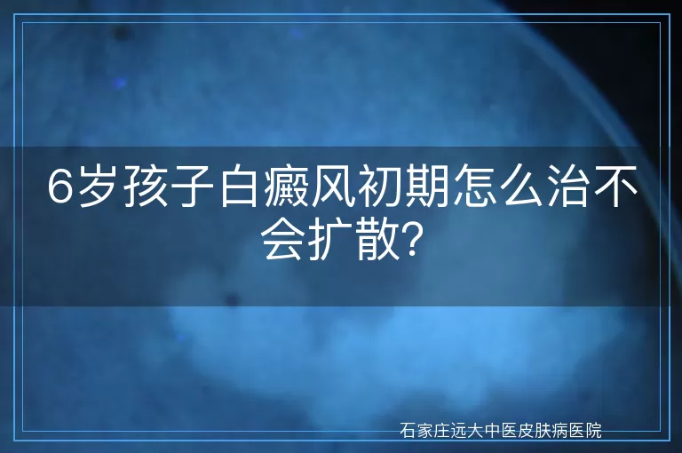 6岁孩子白癜风初期怎么治不会扩散？