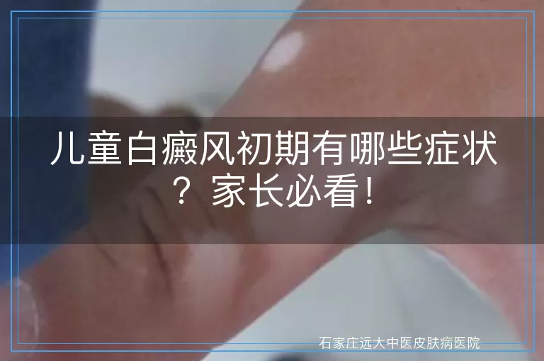 儿童白癜风初期有哪些症状？家长必看！