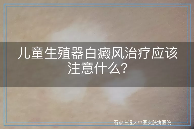 儿童生殖器白癜风治疗应该注意什么？