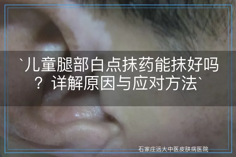 儿童腿部白点抹药能抹好吗？详解原因与应对方法