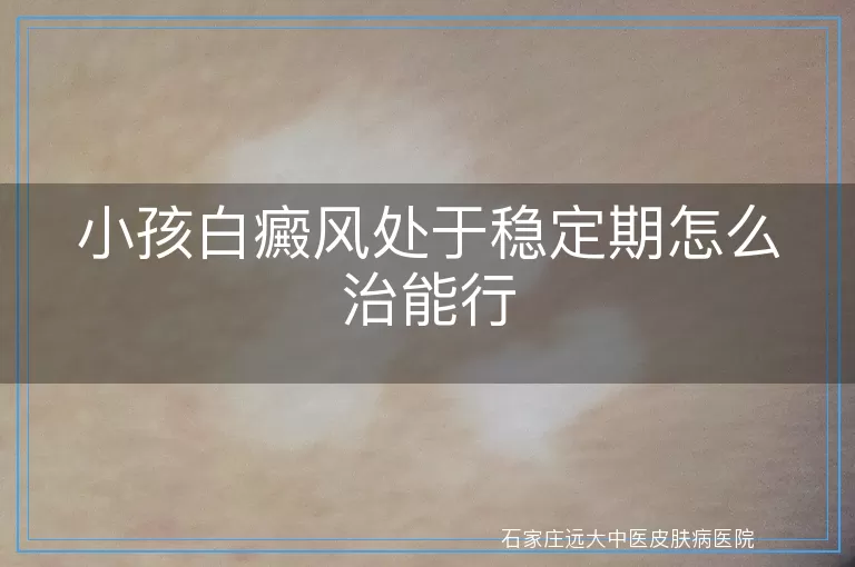 小孩白癜风处于稳定期怎么治能行
