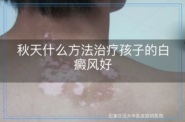 秋天什么方法治疗孩子的白癜风好