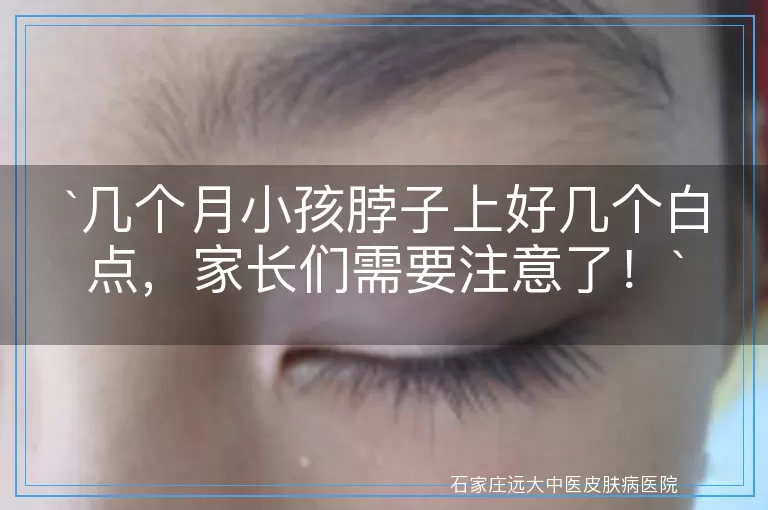 几个月小孩脖子上好几个白点，家长们需要注意了！
