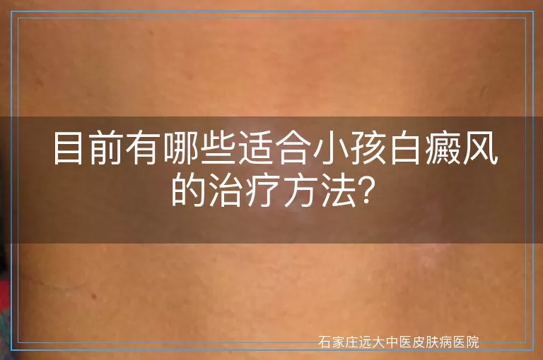 目前有哪些适合小孩白癜风的治疗方法？