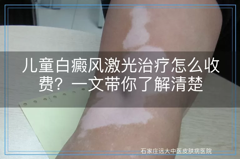 儿童白癜风激光治疗怎么收费？一文带你了解清楚