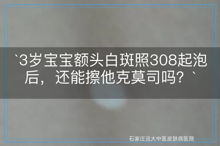 3岁宝宝额头白斑照308起泡后，还能擦他克莫司吗？
