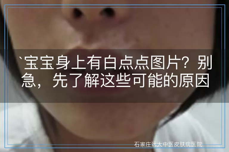 宝宝身上有白点点图片？别急，先了解这些可能的原因！