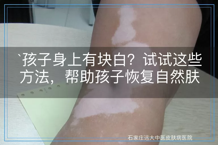 孩子身上有块白？试试这些方法，帮助孩子恢复自然肤色！