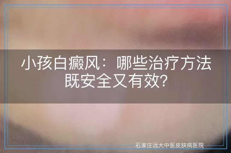小孩白癜风：哪些治疗方法既安全又有效？