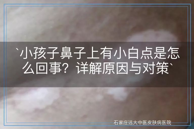 小孩子鼻子上有小白点是怎么回事？详解原因与对策