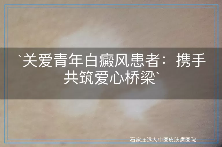 关爱青年白癜风患者：携手共筑爱心桥梁