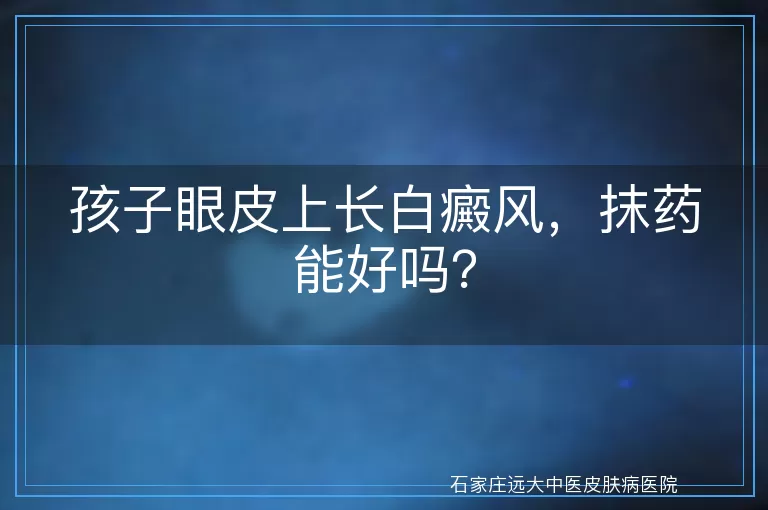 孩子眼皮上长白癜风，抹药能好吗？