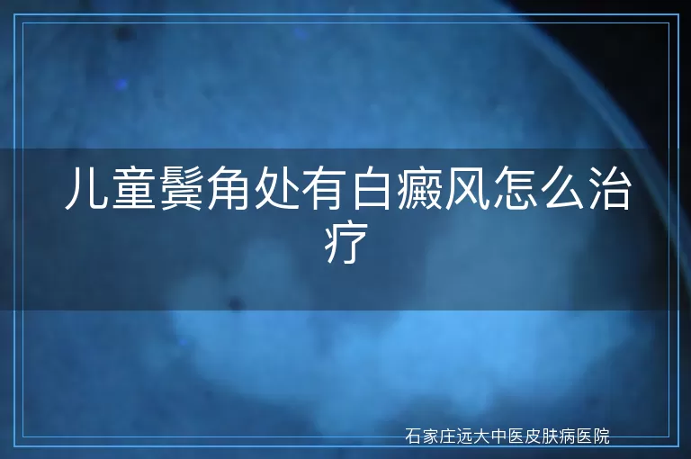 儿童鬓角处有白癜风怎么治疗