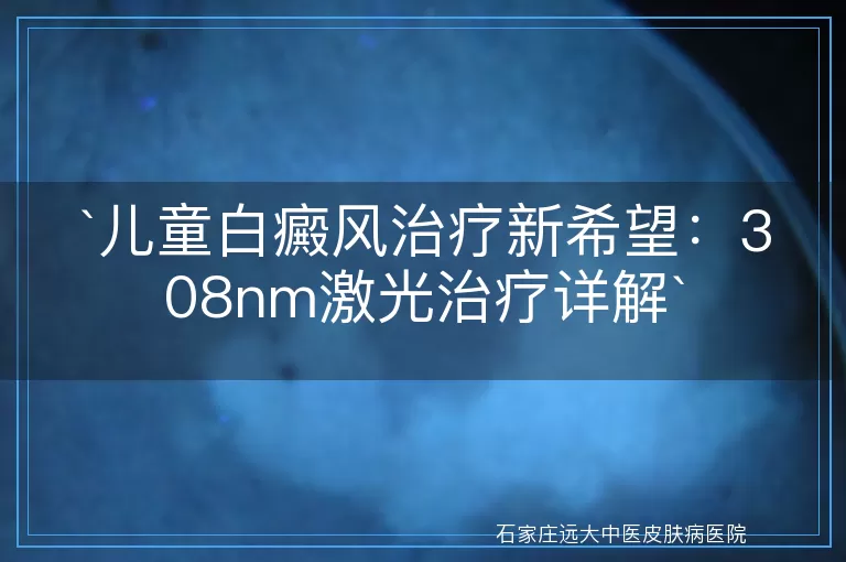 儿童白癜风治疗新希望：308nm激光治疗详解