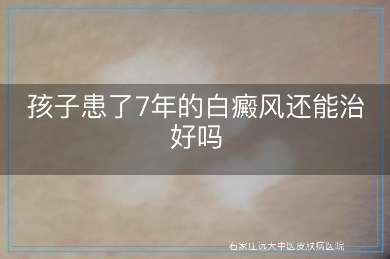 孩子患了7年的白癜风还能治好吗