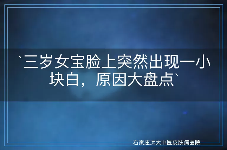 三岁女宝脸上突然出现一小块白，原因大盘点
