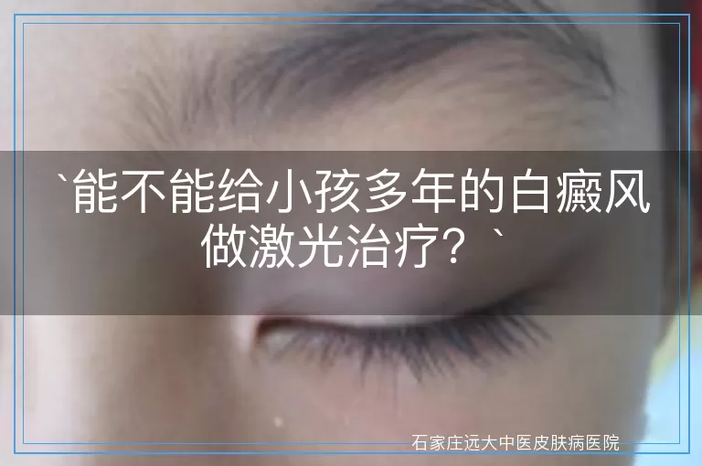 能不能给小孩多年的白癜风做激光治疗？