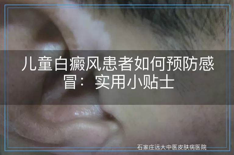 儿童白癜风患者如何预防感冒：实用小贴士
