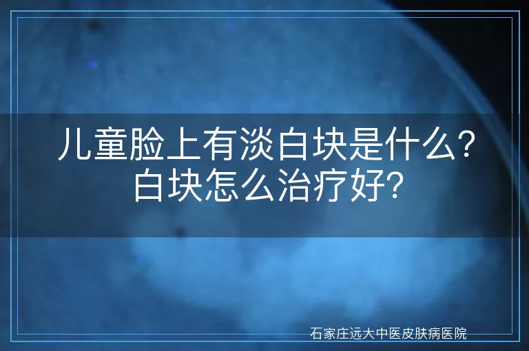 儿童脸上有淡白块是什么？白块怎么治疗好？