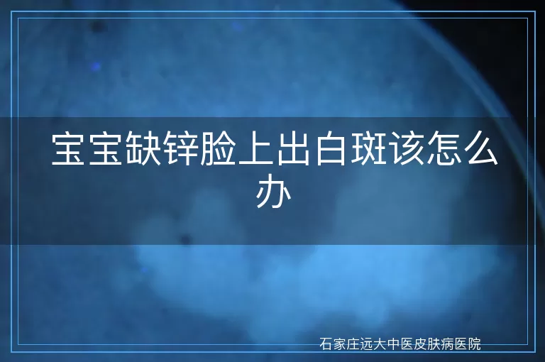 宝宝缺锌脸上出白斑该怎么办