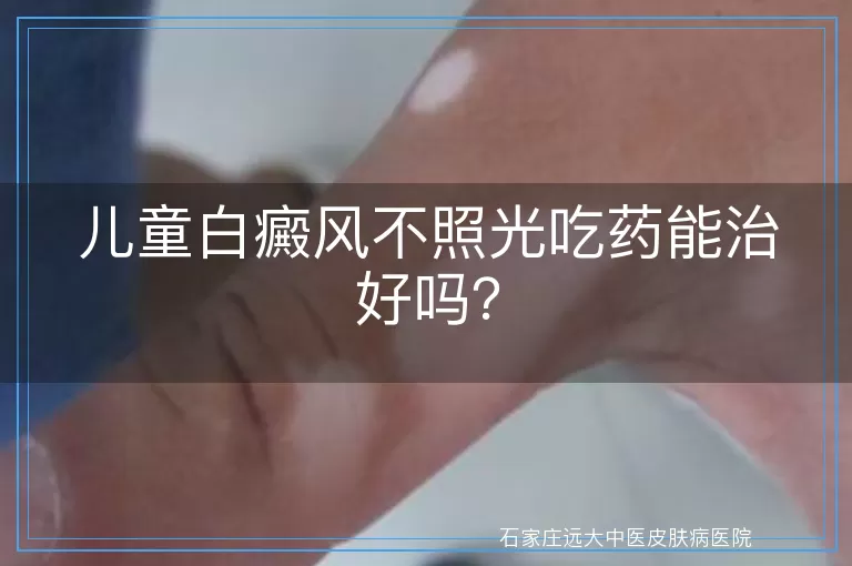 儿童白癜风不照光吃药能治好吗？
