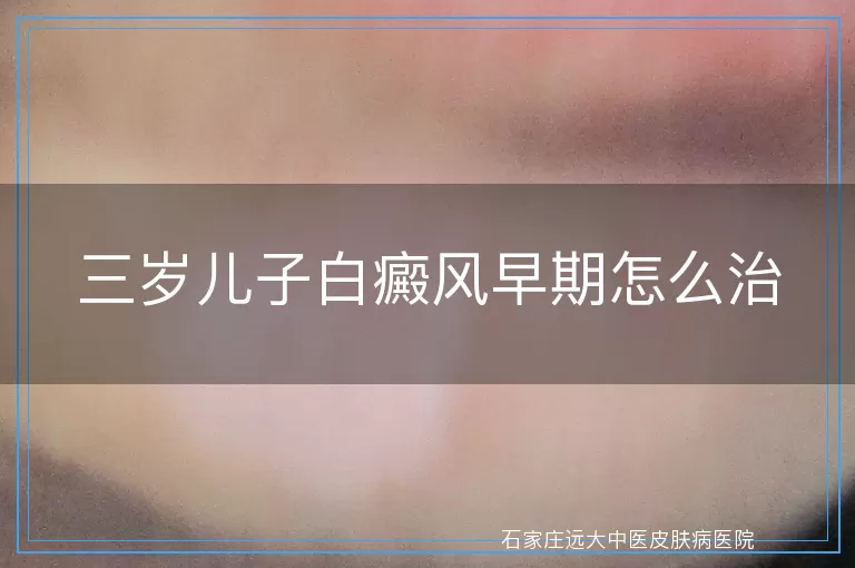 三岁儿子白癜风早期怎么治