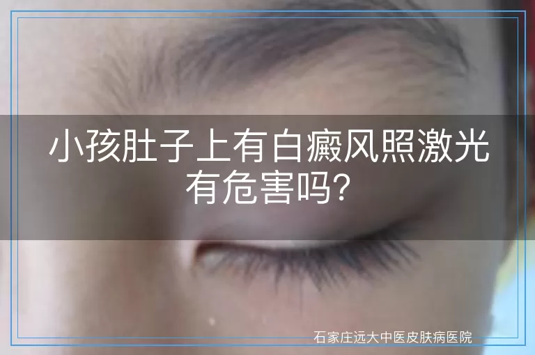 小孩肚子上有白癜风照激光有危害吗？