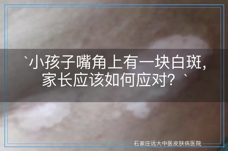 小孩子嘴角上有一块白斑，家长应该如何应对？