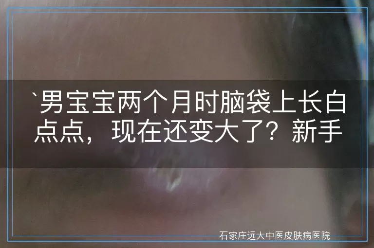 男宝宝两个月时脑袋上长白点点，现在还变大了？新手爸妈必看！