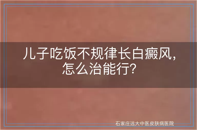 儿子吃饭不规律长白癜风，怎么治能行？