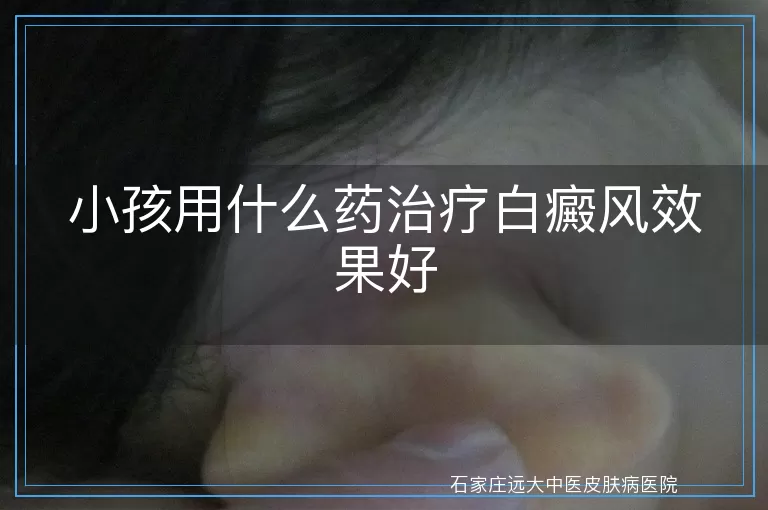 小孩用什么药治疗白癜风效果好