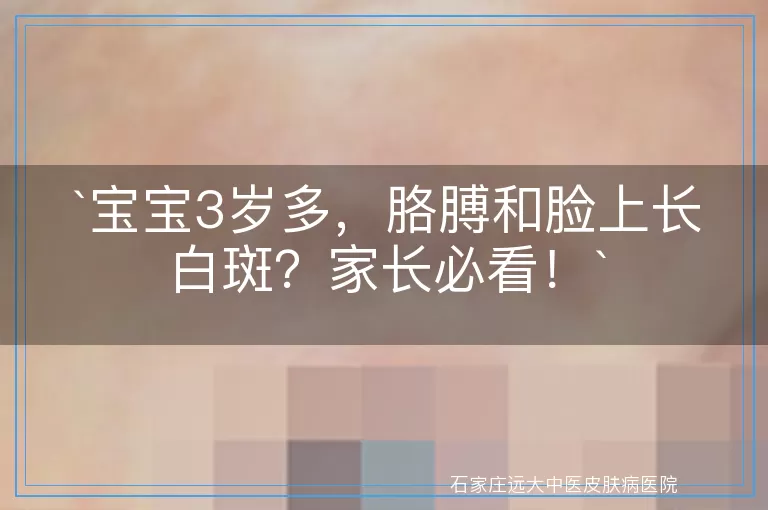 宝宝3岁多，胳膊和脸上长白斑？家长必看！