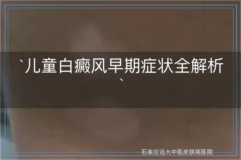 儿童白癜风早期症状全解析