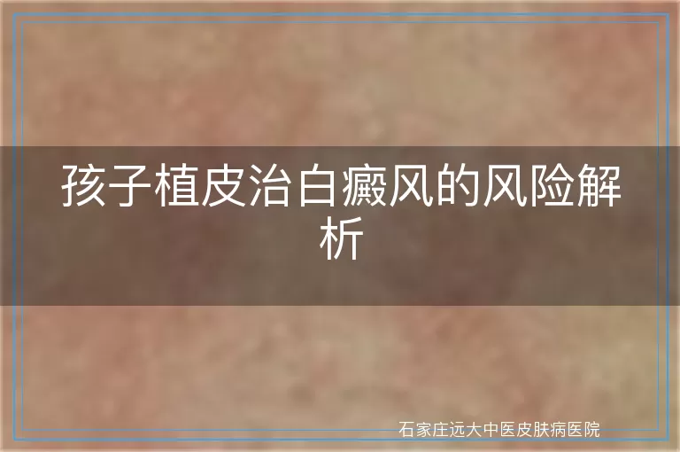 孩子植皮治白癜风的风险解析