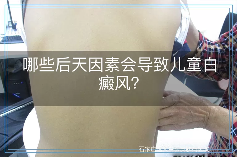 哪些后天因素会导致儿童白癜风？
