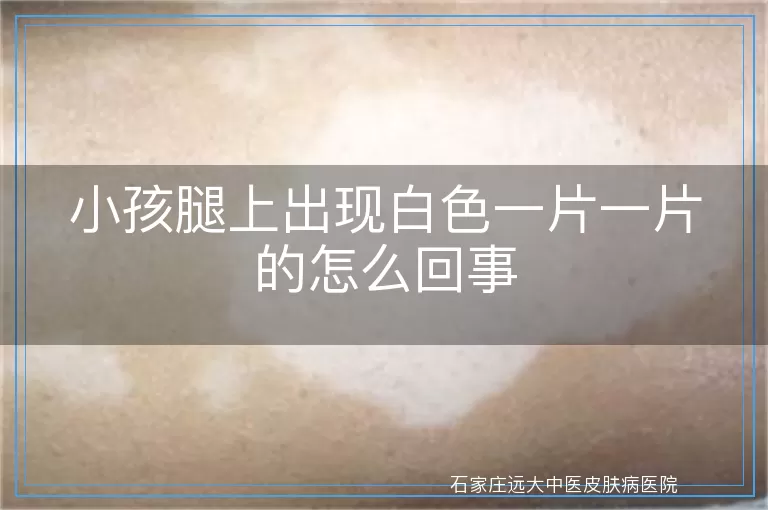 小孩腿上出现白色一片一片的怎么回事