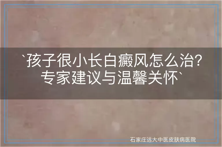 孩子很小长白癜风怎么治？专家建议与温馨关怀