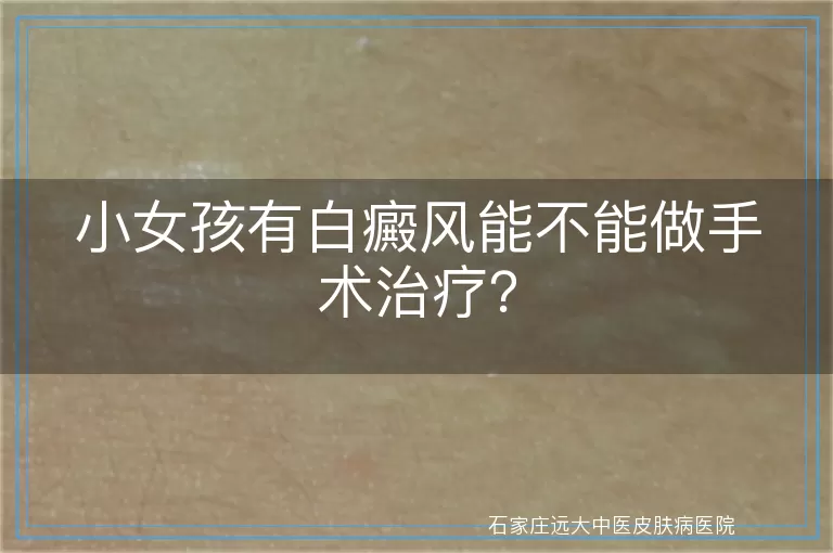 小女孩有白癜风能不能做手术治疗？