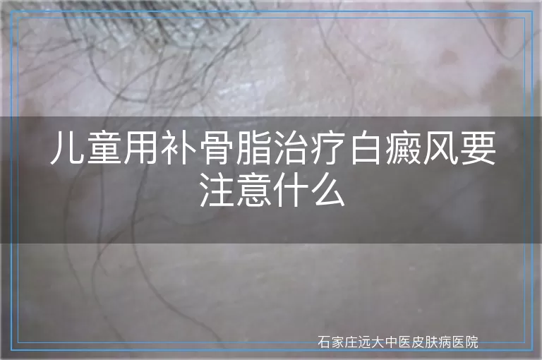 儿童用补骨脂治疗白癜风要注意什么