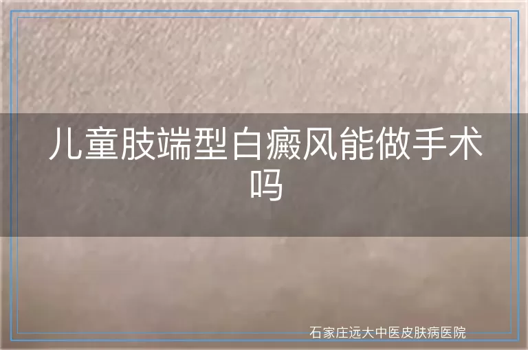 儿童肢端型白癜风能做手术吗