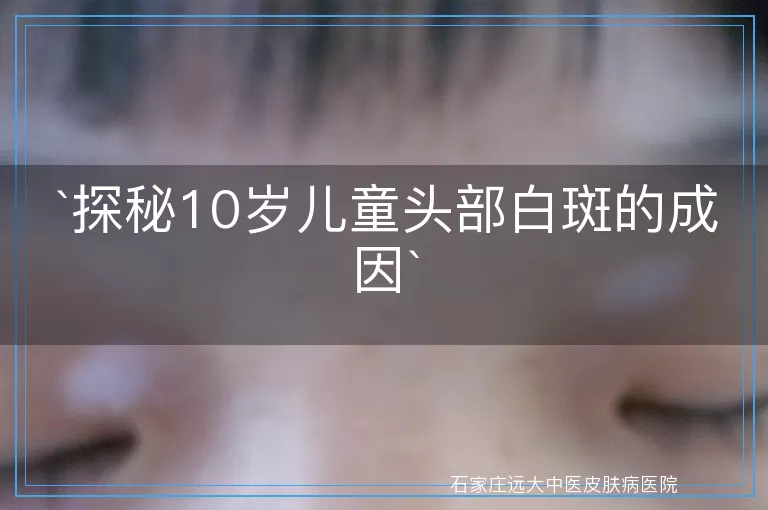 探秘10岁儿童头部白斑的成因
