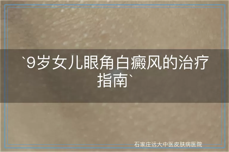 9岁女儿眼角白癜风的治疗指南