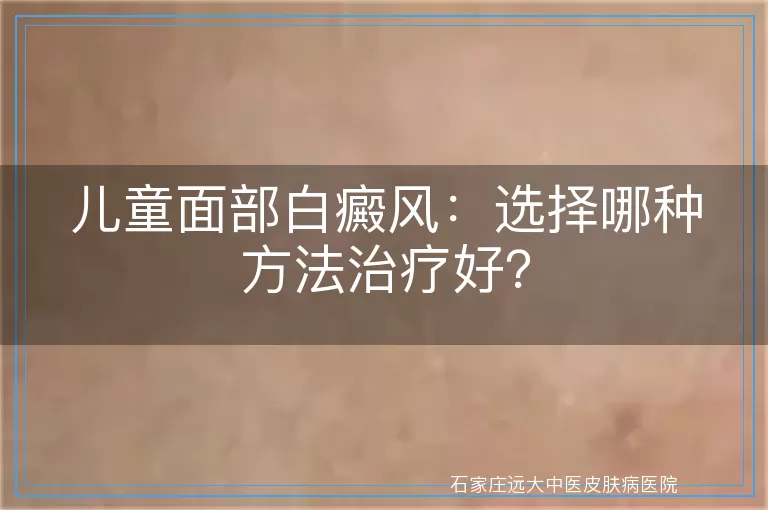 儿童面部白癜风：选择哪种方法治疗好？