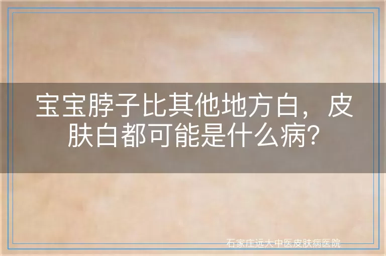 宝宝脖子比其他地方白，皮肤白都可能是什么病？