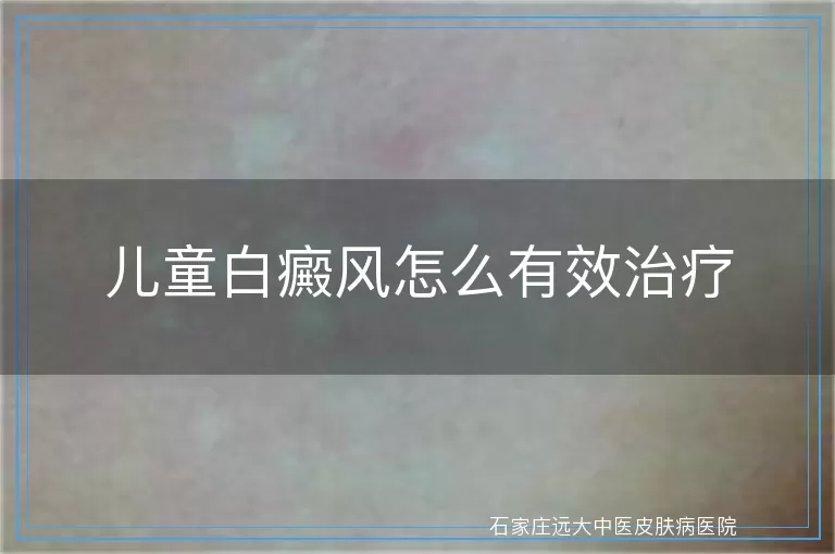 儿童白癜风怎么有效治疗